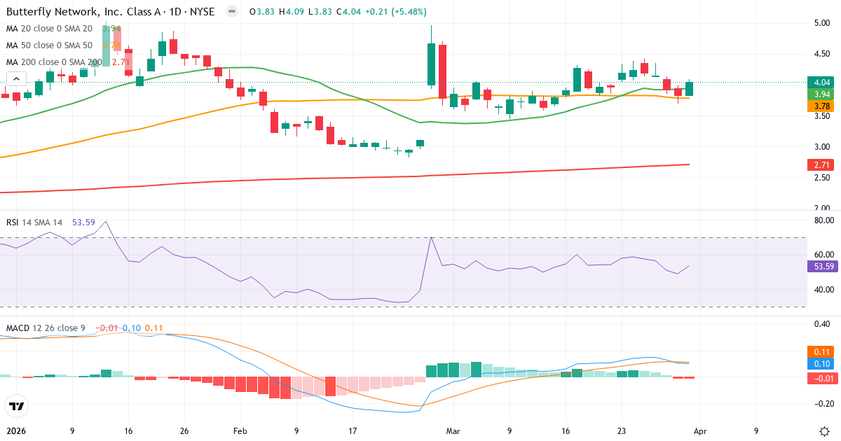 Technische Analyse von Butterfly Network (BFLY.US) – RSI 54, MACD positiv (bullisch), tägliche Candlestick-Grafik April 2026