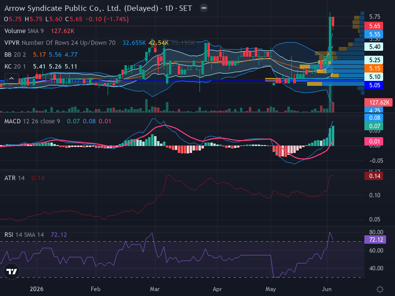 Trading Chart
