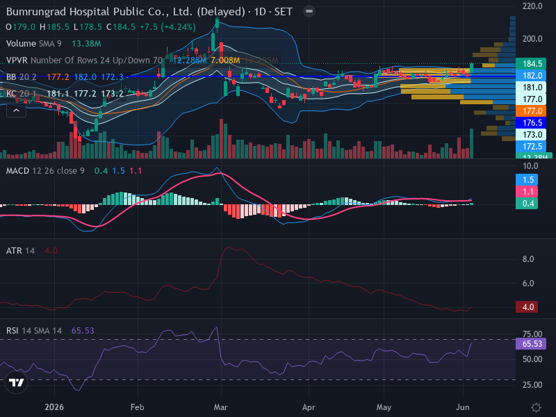 Trading Chart